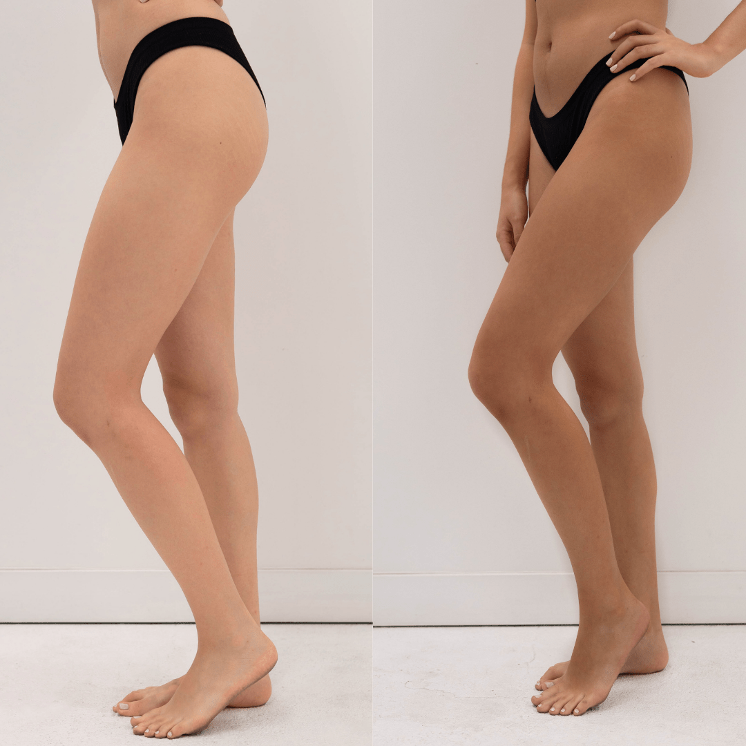 Eco Tan Winter Skin before after legs result gradual natural tan and moisturiser