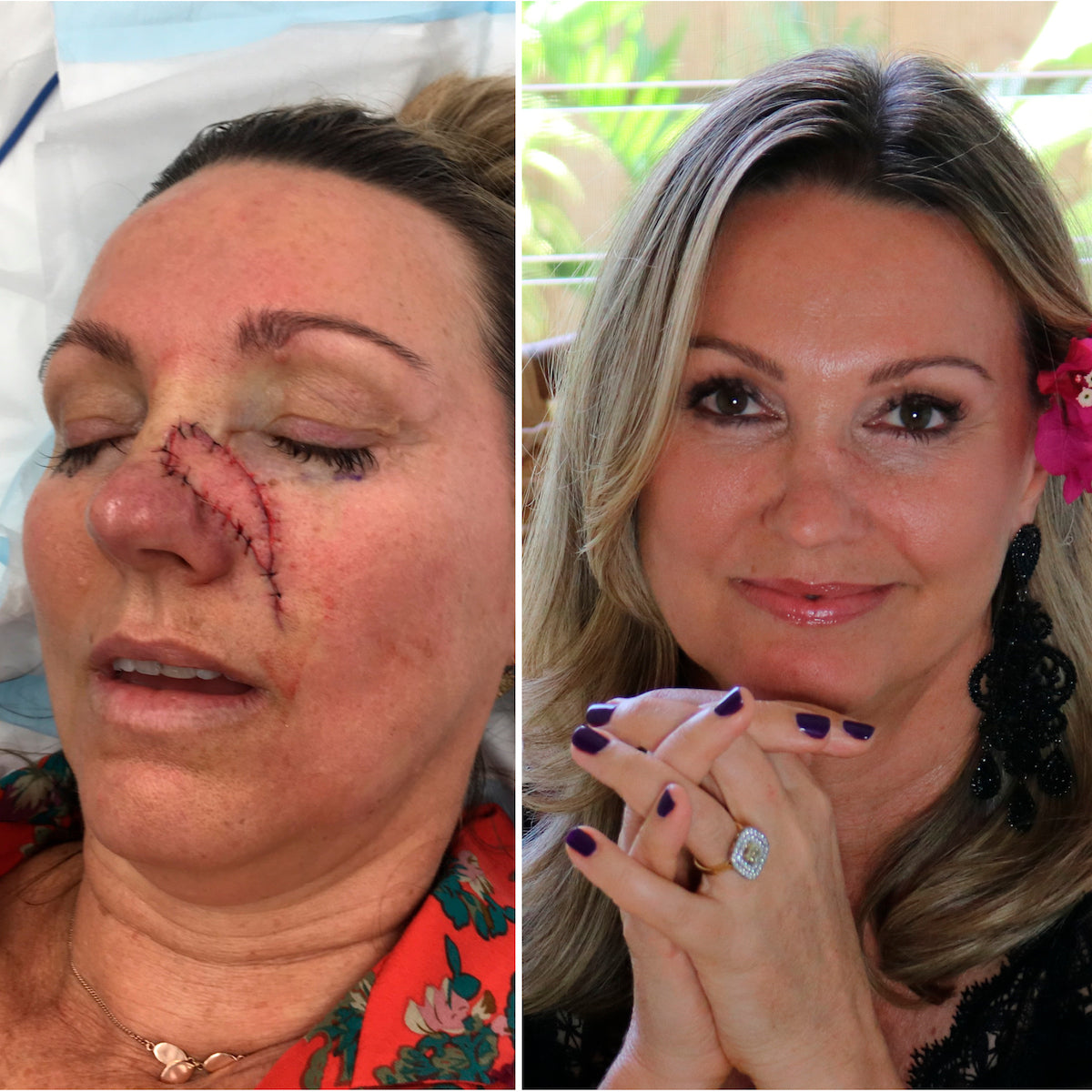 Glory Oil Best Face Oil Eco Tan Australia